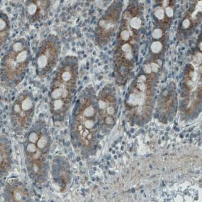 Immunohistochemistry-Paraffin: PGAM5 Antibody (CL0624) [NBP2-52947]