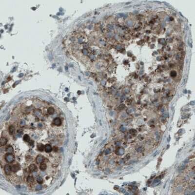 Immunohistochemistry-Paraffin: PGAM5 Antibody (CL0624) [NBP2-52947]