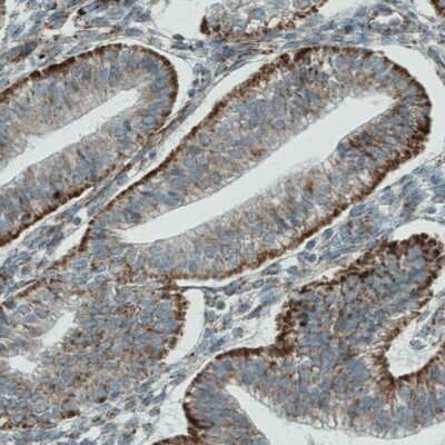 Immunohistochemistry-Paraffin: PGAM5 Antibody (CL0624) [NBP2-52947]