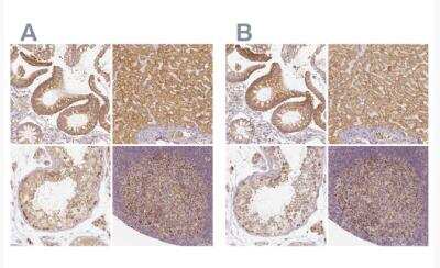 Immunohistochemistry-Paraffin: PGAM5 Antibody [NBP1-92257]
