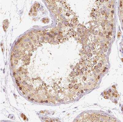 Immunohistochemistry-Paraffin: PGAM5 Antibody [NBP1-92257]