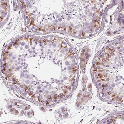 Immunohistochemistry: PGAP1 Antibody [NBP2-38121]