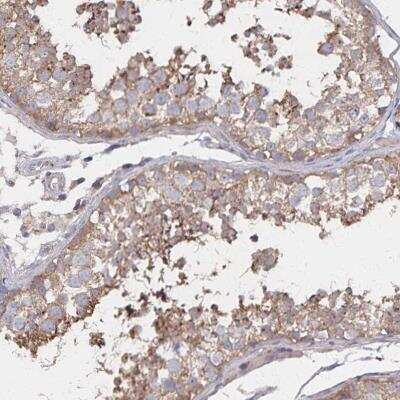 Immunohistochemistry-Paraffin: PGAP2 Antibody [NBP2-31867]