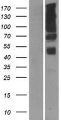 Western Blot: PGAP2 Overexpression Lysate [NBP2-07326]