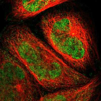 Immunocytochemistry/ Immunofluorescence: PGBD1 Antibody [NBP1-85162]