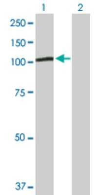 Western Blot: PGBD1 Antibody [H00084547-D01P]