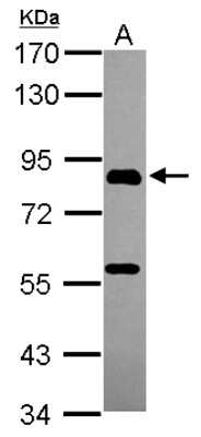 Western Blot: PGBD1 Antibody [NBP2-19782]