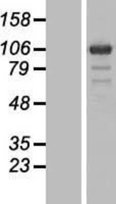 Western Blot: PGBD1 Overexpression Lysate [NBP2-06012]