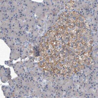 Immunohistochemistry: PGBD2 Antibody [NBP1-86348]