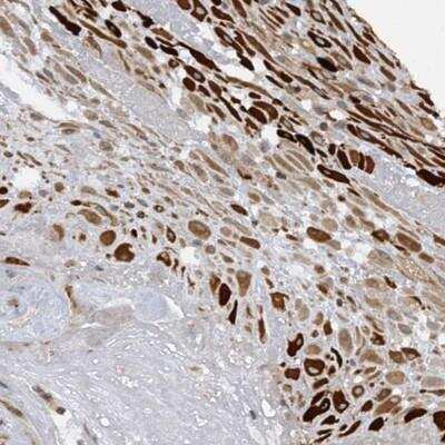 Immunohistochemistry: PGBD2 Antibody [NBP1-86349]