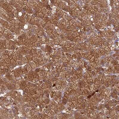 Immunohistochemistry-Paraffin: PGBD4 Antibody [NBP1-81995]