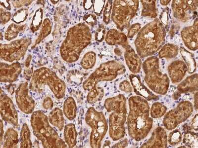 Immunohistochemistry-Paraffin: PGBD4 Antibody [NBP2-98194]