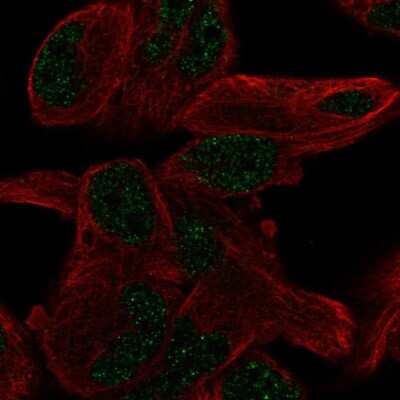 Immunocytochemistry/ Immunofluorescence: PGBD5 Antibody [NBP2-57708]