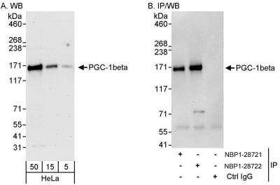 Western Blot: PGC-1 beta Antibody [NBP1-28722]