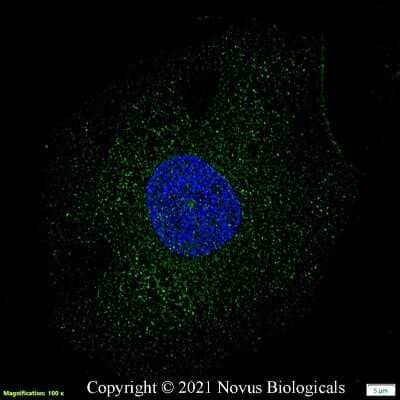 Fluorescent Staining of PGC1 alpha in HeLa Cells