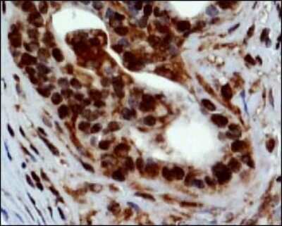Immunohistological Staining of PGC1 alpha in Paraffin Embedded Mouse Prostate