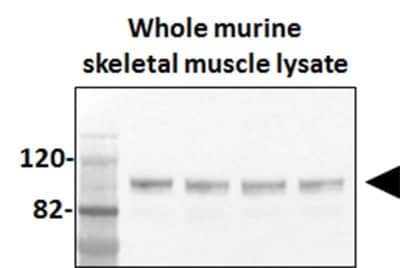 Detection of PGC1 alpha in Murine Skeletal Muscle by Western Blot