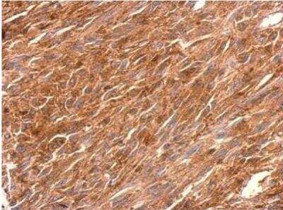 Immunohistochemistry-Paraffin: PGCP Antibody [NBP1-32328]