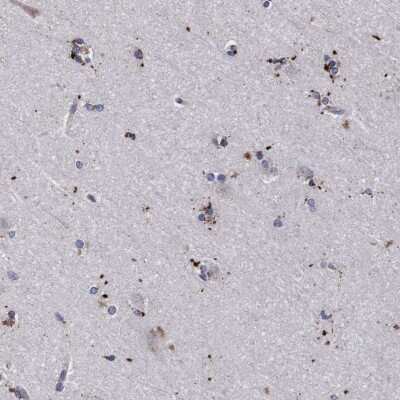 Immunohistochemistry-Paraffin: PGCP Antibody [NBP1-87457]