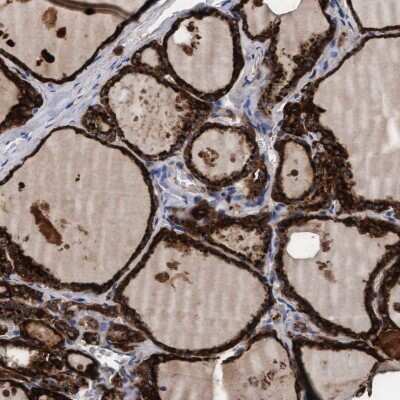 Immunohistochemistry-Paraffin: PGCP Antibody [NBP1-87457]