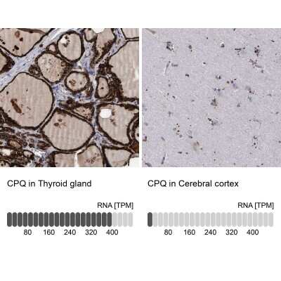 Immunohistochemistry-Paraffin: PGCP Antibody [NBP1-87457]