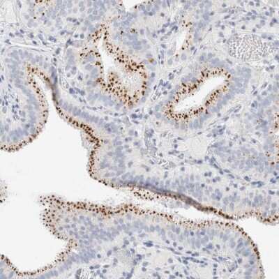 Immunohistochemistry-Paraffin: PGCP Antibody [NBP1-87545]