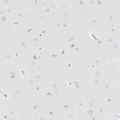 Immunohistochemistry-Paraffin: PGCP Antibody [NBP1-87545]