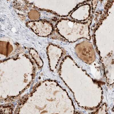 Immunohistochemistry-Paraffin: PGCP Antibody [NBP1-87545]