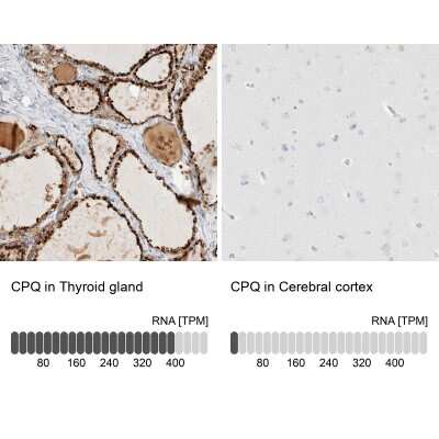 Immunohistochemistry-Paraffin: PGCP Antibody [NBP1-87545]