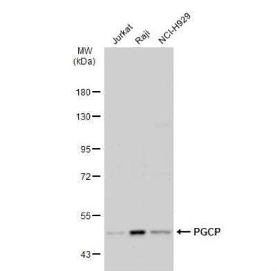 Western Blot: PGCP Antibody [NBP1-32328]