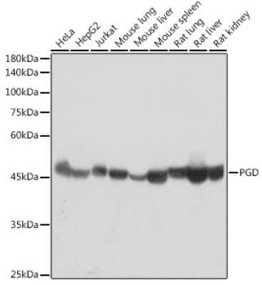 Western Blot: PGD Antibody (9A2M7) [NBP3-15277]