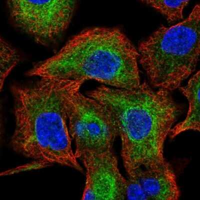 Immunocytochemistry/ Immunofluorescence: PGD Antibody [NBP2-58686]