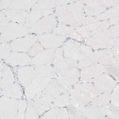 Immunohistochemistry-Paraffin: PGD Antibody [NBP1-85925]