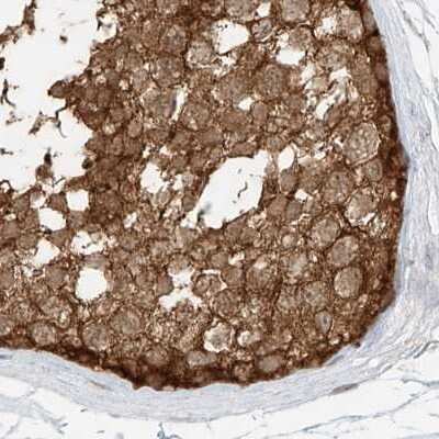 Immunohistochemistry-Paraffin: PGD Antibody [NBP1-85925]