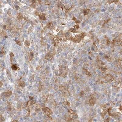 Immunohistochemistry-Paraffin: PGD Antibody [NBP1-85925]