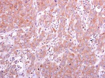 Immunohistochemistry-Paraffin: PGD Antibody [NBP2-19783]