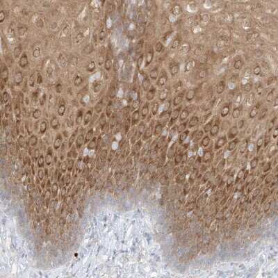 Immunohistochemistry-Paraffin: PGD Antibody [NBP2-58686]