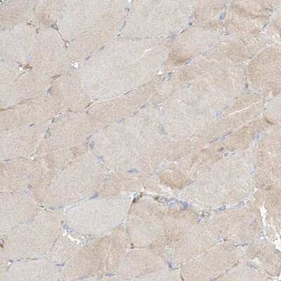 Immunohistochemistry-Paraffin: PGD Antibody [NBP2-58686]