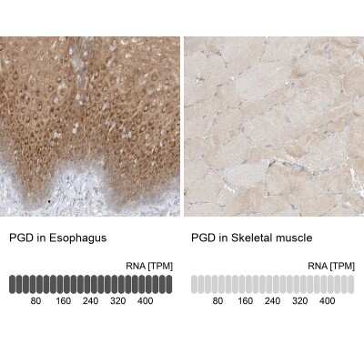 Immunohistochemistry-Paraffin: PGD Antibody [NBP2-58686]