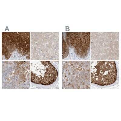 Immunohistochemistry-Paraffin: PGD Antibody [NBP2-58686]