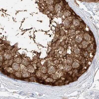 Immunohistochemistry-Paraffin: PGD Antibody [NBP2-58686]