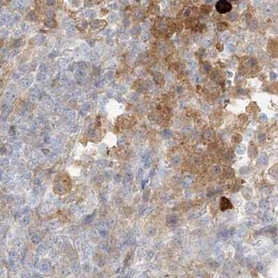 Immunohistochemistry-Paraffin: PGD Antibody [NBP2-58686]