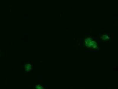 Immunocytochemistry/ Immunofluorescence: PGD Antibody (OTI2A5) - Azide and BSA Free [NBP2-73361]