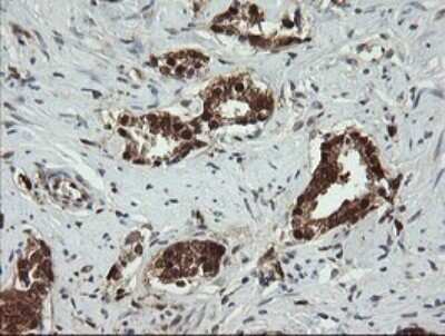 Immunohistochemistry: PGD Antibody (OTI2A5) - Azide and BSA Free [NBP2-73361]