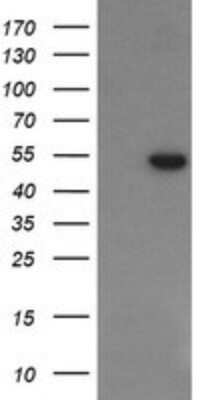 Western Blot: PGD Antibody (OTI2A5)Azide and BSA Free [NBP2-73361]