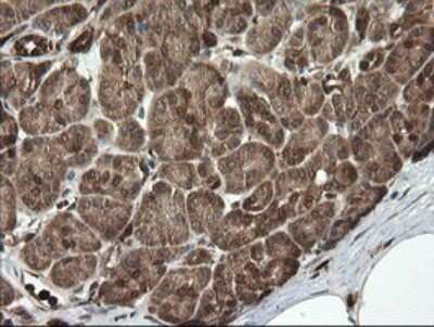 Immunohistochemistry-Paraffin: PGD Antibody (OTI2A5) [NBP2-45880]