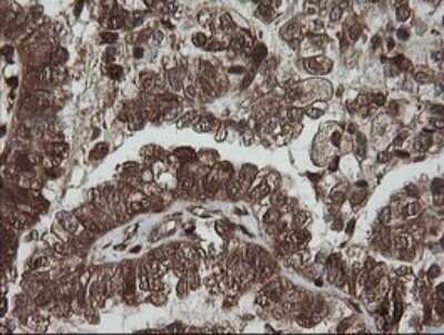 Immunohistochemistry-Paraffin: PGD Antibody (OTI2A5) [NBP2-45880]