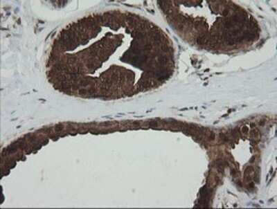 Immunohistochemistry-Paraffin: PGD Antibody (OTI2A5) [NBP2-45880]