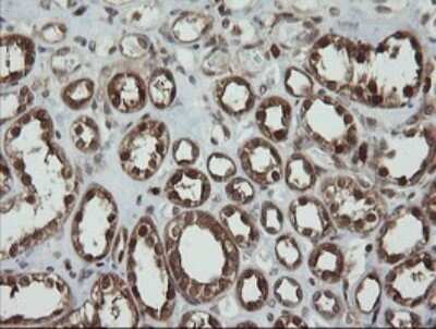 Immunohistochemistry-Paraffin: PGD Antibody (OTI2A5) [NBP2-45880]