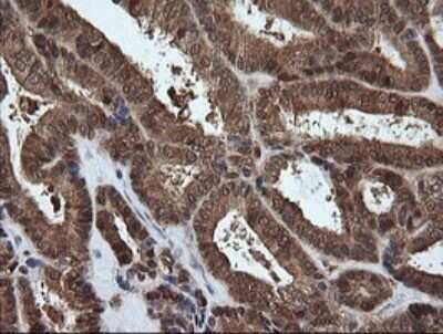 Immunohistochemistry-Paraffin: PGD Antibody (OTI2A5) [NBP2-45880]